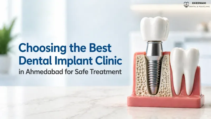 Choosing the Best Dental Implant Clinic in Ahmedabad for Safe Treatmen