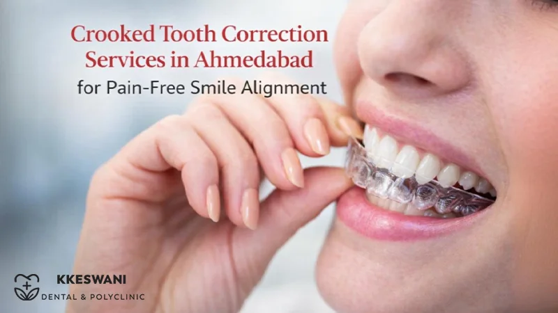 Crooked Tooth Correction Services in Ahmedabad for Pain-Free Smile Ali