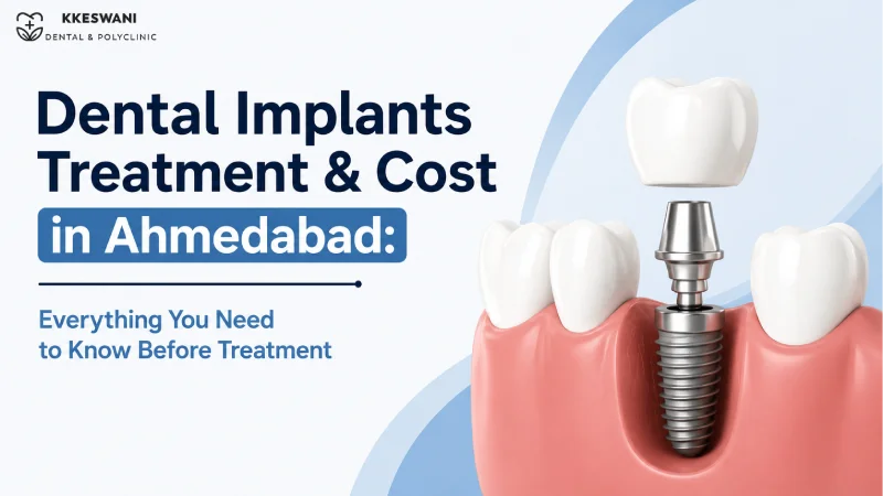 Dental Implants Treatment & Cost in Ahmedabad: Everything You Need to 