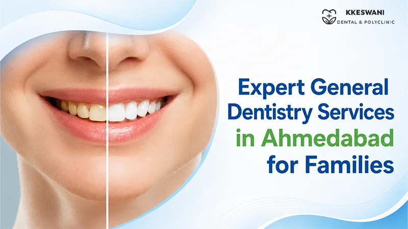 Expert General Dentistry Services in Ahmedabad for Families
