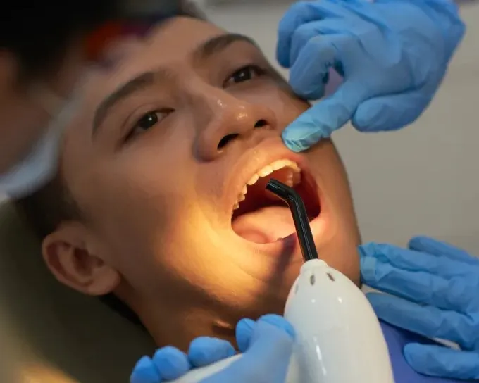 Teeth Filling Treatment Services
