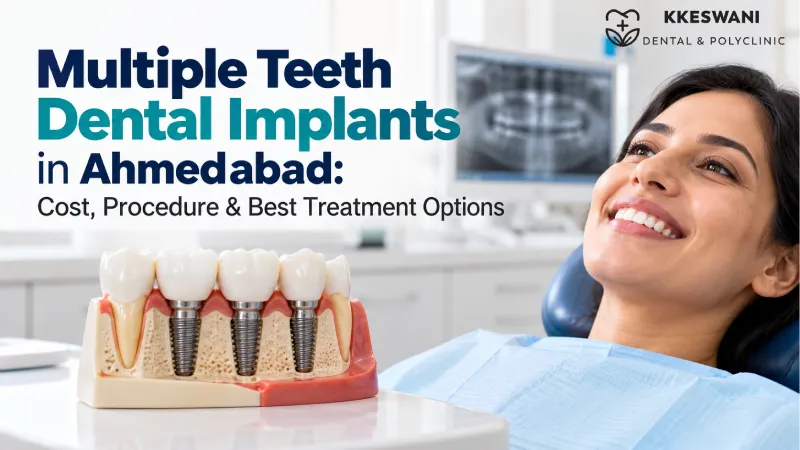 Multiple Teeth Dental Implants in Ahmedabad: Cost, Procedure & Best Treatment Options