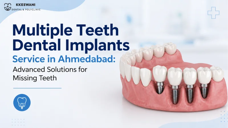 Multiple Teeth Dental Implants Service in Ahmedabad: Advanced Solution
