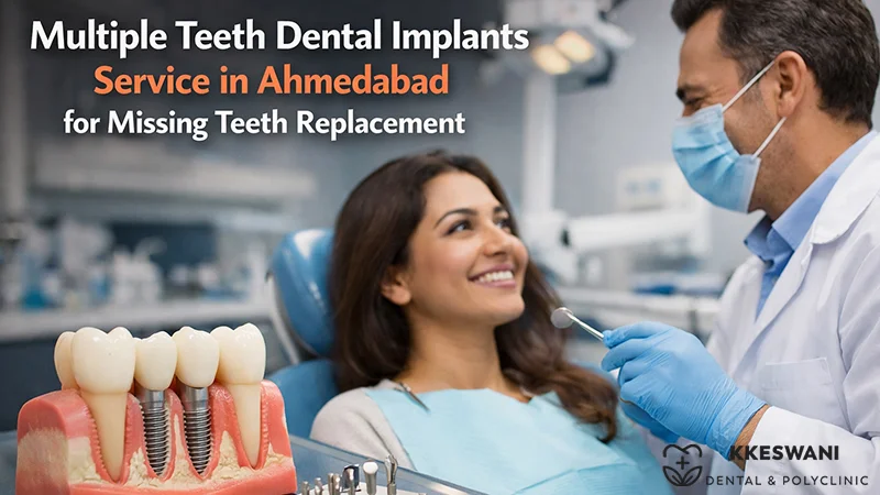Multiple Teeth Dental Implants Service in Ahmedabad for Missing Teeth 