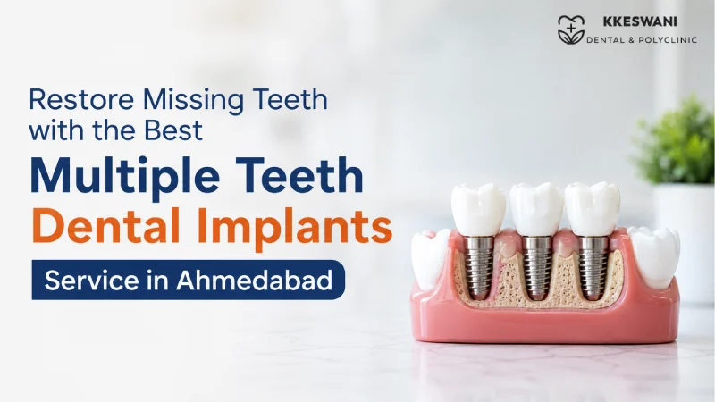Restore Missing Teeth with the Best Multiple Teeth Dental Implants Ser