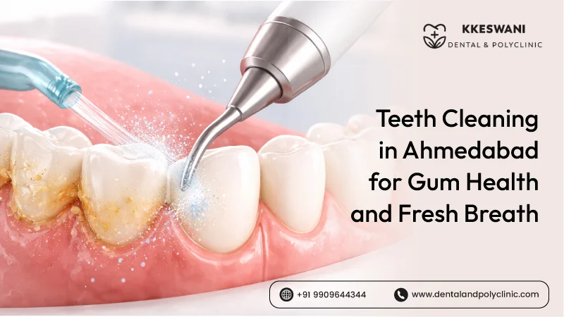 Teeth Cleaning in Ahmedabad for Gum Health and Fresh Breath