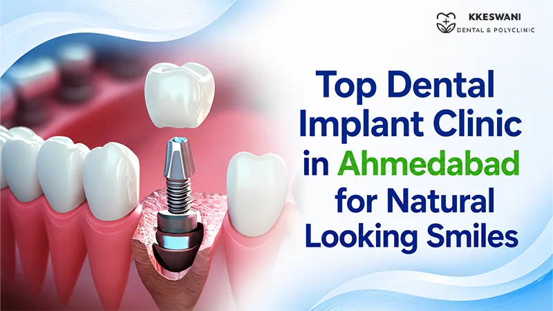 Top Dental Implant Clinic in Ahmedabad for Natural Looking Smiles