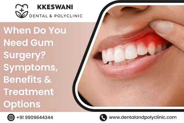 When Do You Need Gum Surgery? Symptoms, Benefits & Treatment Options