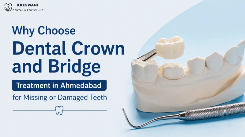 Why Choose Dental Crown and Bridge Treatment in Ahmedabad for Missing 