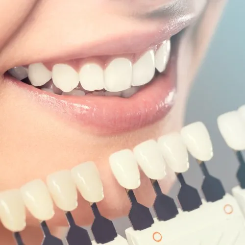 Cosmetic Dentistry