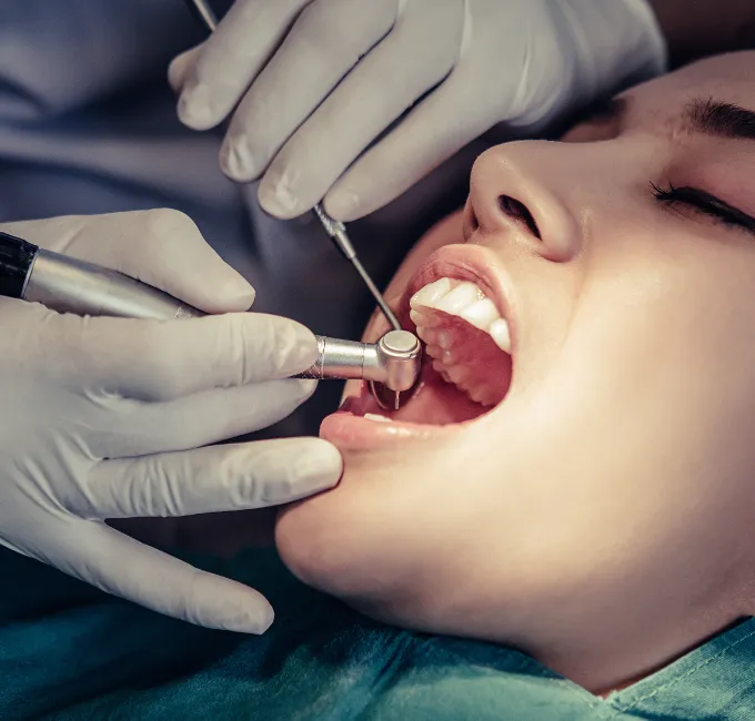 Teeth Cleaning & Polishing Services