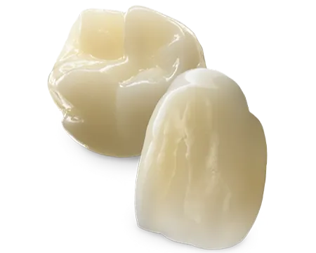 Unveiling Excellence in Dental Care: 3M Lava Esthetic Tooth Fillings