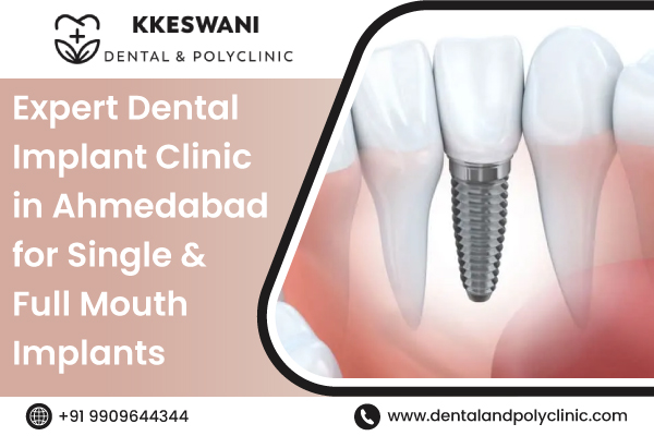 Expert Dental Implant Clinic in Ahmedabad for Single & Full Mouth Implants