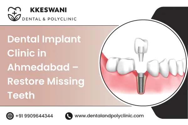 Dental Implant Clinic in Ahmedabad – Restore Missing Teeth