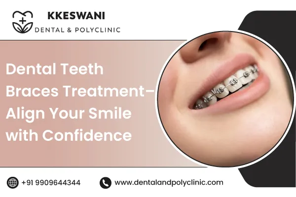 Dental Teeth Braces Treatment – Align Your Smile with Confidence