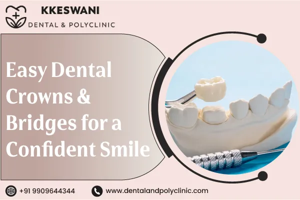 Easy Dental Crowns & Bridges for a Confident Smile