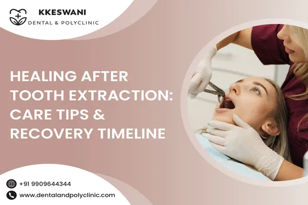 Healing After Tooth Extraction: Care Tips & Recovery Timeline