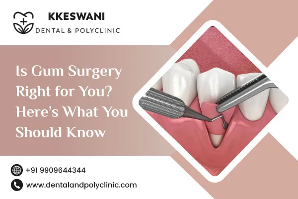 Is Gum Surgery Right for You? Here’s What You Should Know