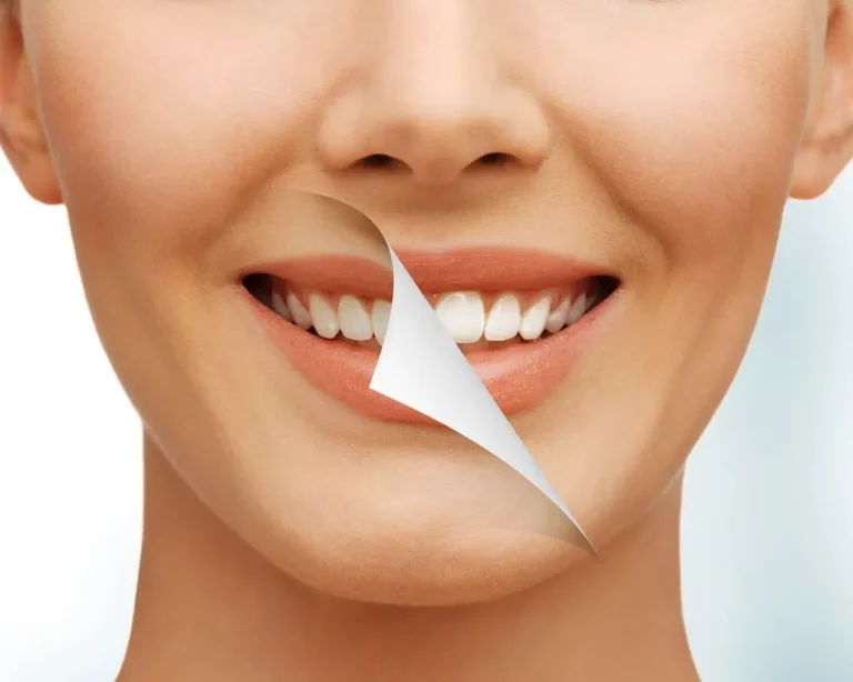 Brighten Your Smile with Kkeswani Dental & Polyclinic’s Philips Zoom Teeth Bleaching Service