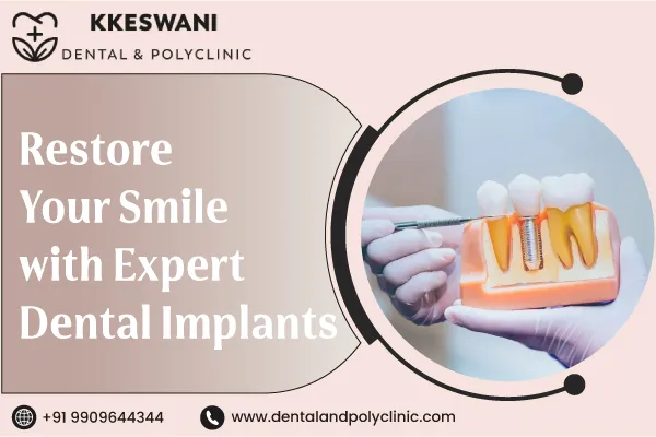 Restore Your Smile with Expert Dental Implants