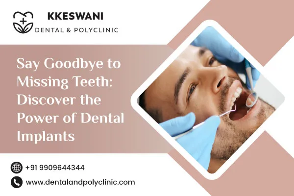 Say Goodbye to Missing Teeth: Discover the Power of Dental Implants