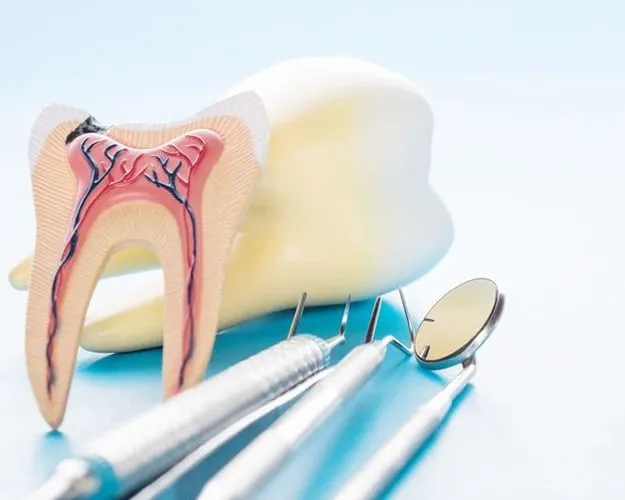 Tips for Care After Root Canal Treatment