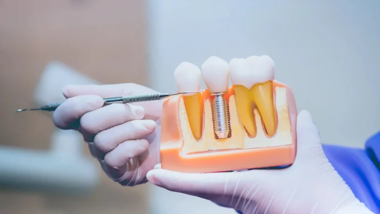 Top Dental Specialists – Root Canal, Braces & More