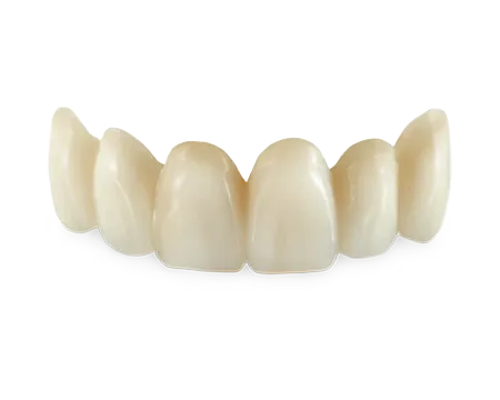 Elevate Your Smile with Kkeswani Dental & Polyclinic’s Zirconia Crowns and Bridges