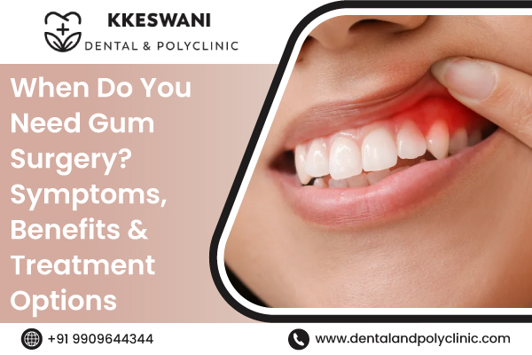When Do You Need Gum Surgery? Symptoms, Benefits & Treatment Options