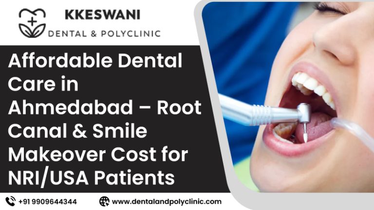 Affordable Dental Care in Ahmedabad – Root Canal & Smile Makeover Cost for NRI/USA Patients