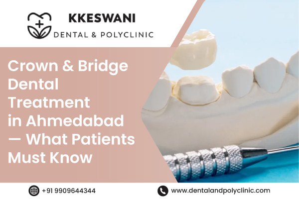 Crown & Bridge Dental Treatment in Ahmedabad — What Patients Must Know
