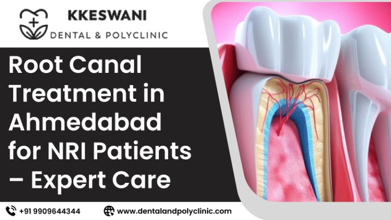 Root Canal Treatment in Ahmedabad for NRI Patients – Expert Care