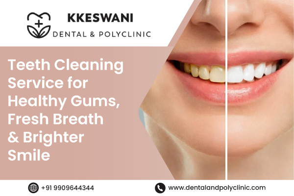 Teeth Cleaning Service for Healthy Gums, Fresh Breath & Brighter Smile