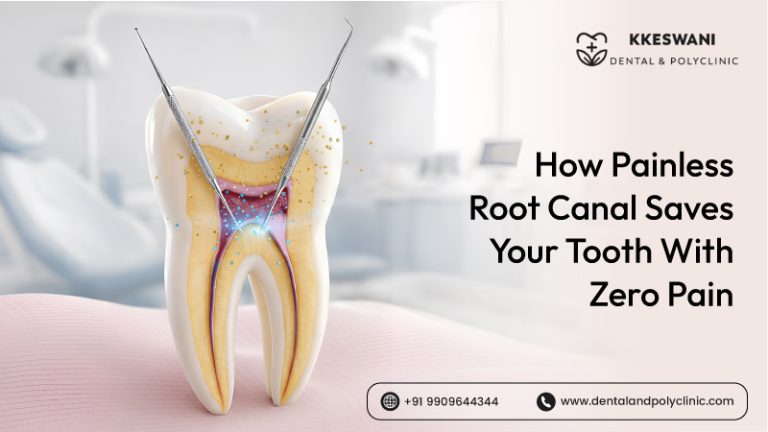 How Painless Root Canal Saves Your Tooth with Zero Pain