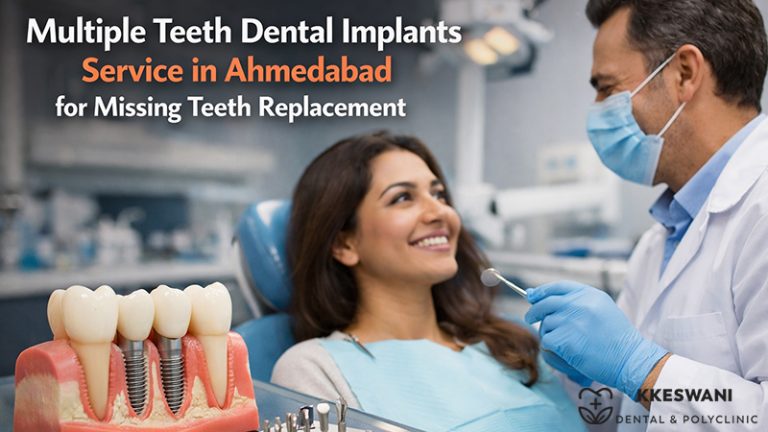 Multiple Teeth Dental Implants Service in Ahmedabad for Missing Teeth Replacement