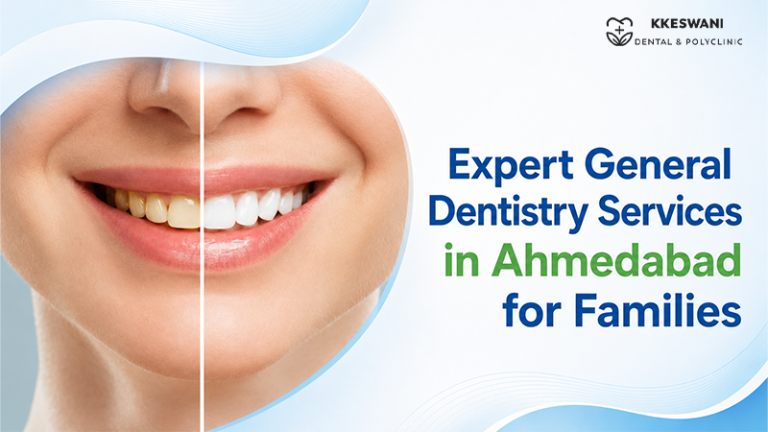 Expert General Dentistry Services in Ahmedabad for Families