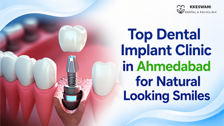Top Dental Implant Clinic in Ahmedabad for Natural Looking Smiles
