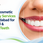 Expert Cosmetic Dentistry Services in Ahmedabad for Beautiful & Healthy Teeth