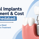 Dental Implants Treatment & Cost in Ahmedabad: Everything You Need to Know Before Treatment