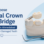 Why Choose Dental Crown and Bridge Treatment in Ahmedabad for Missing or Damaged Teeth