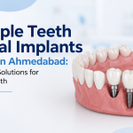 Multiple Teeth Dental Implants Service in Ahmedabad: Advanced Solutions for Missing Teeth