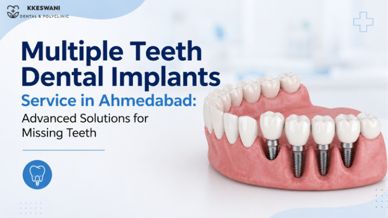 Multiple Teeth Dental Implants Service in Ahmedabad: Advanced Solutions for Missing Teeth