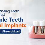 Restore Missing Teeth with the Best Multiple Teeth Dental Implants Service in Ahmedabad